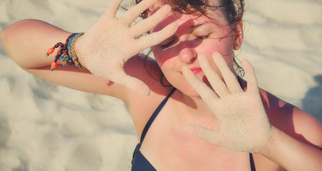 Solar dermatitis: symptomer, årsager og hvordan man behandler